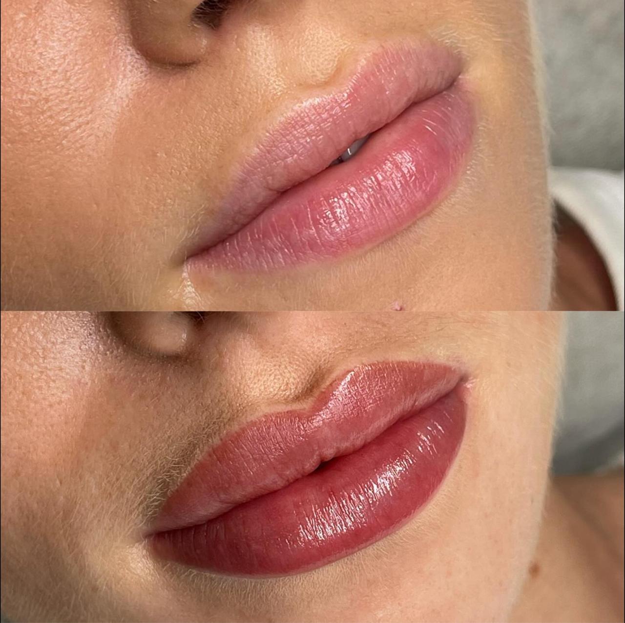 Cosmetic Tattoo — Lip Blush